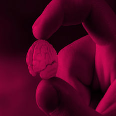 הדמיה - מוח מכווץ