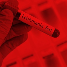 בדיקה לישמניה