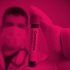 מבחנה במעבדה