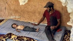 עבדול קאדר אל-פיומי שסובל ממחלה גנטית