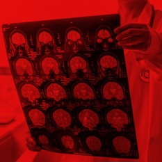 תוצאות סריקת מוח