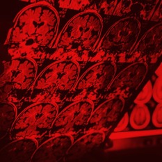 תוצאות סריקת מוח